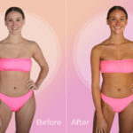 Before and after spray tan picture of a woman in a pink bikini.